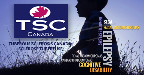 About Us - TSC Canada